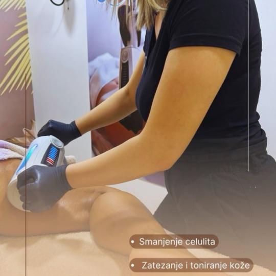 Diana Body & Hair Studio #beograd Tretmani tela Endosfera tela - paket od 7 tretmana + 5 gratis