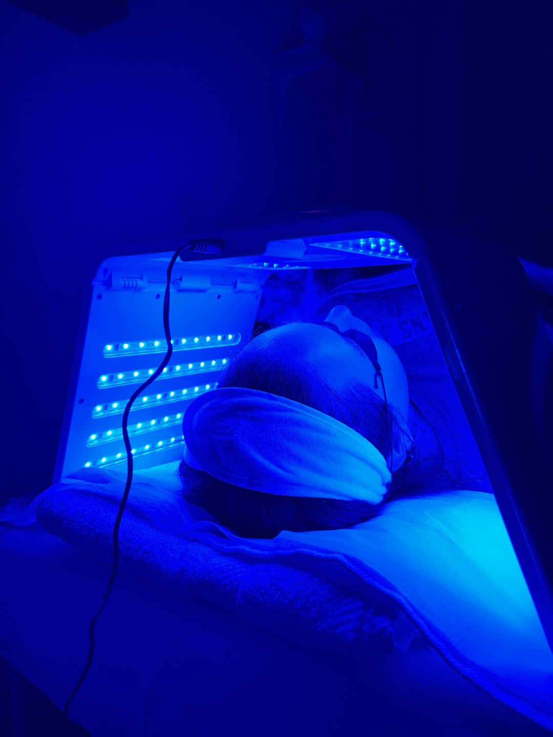 Sandra estetik studio #beograd Tretman lica led svetlosna terapija lica