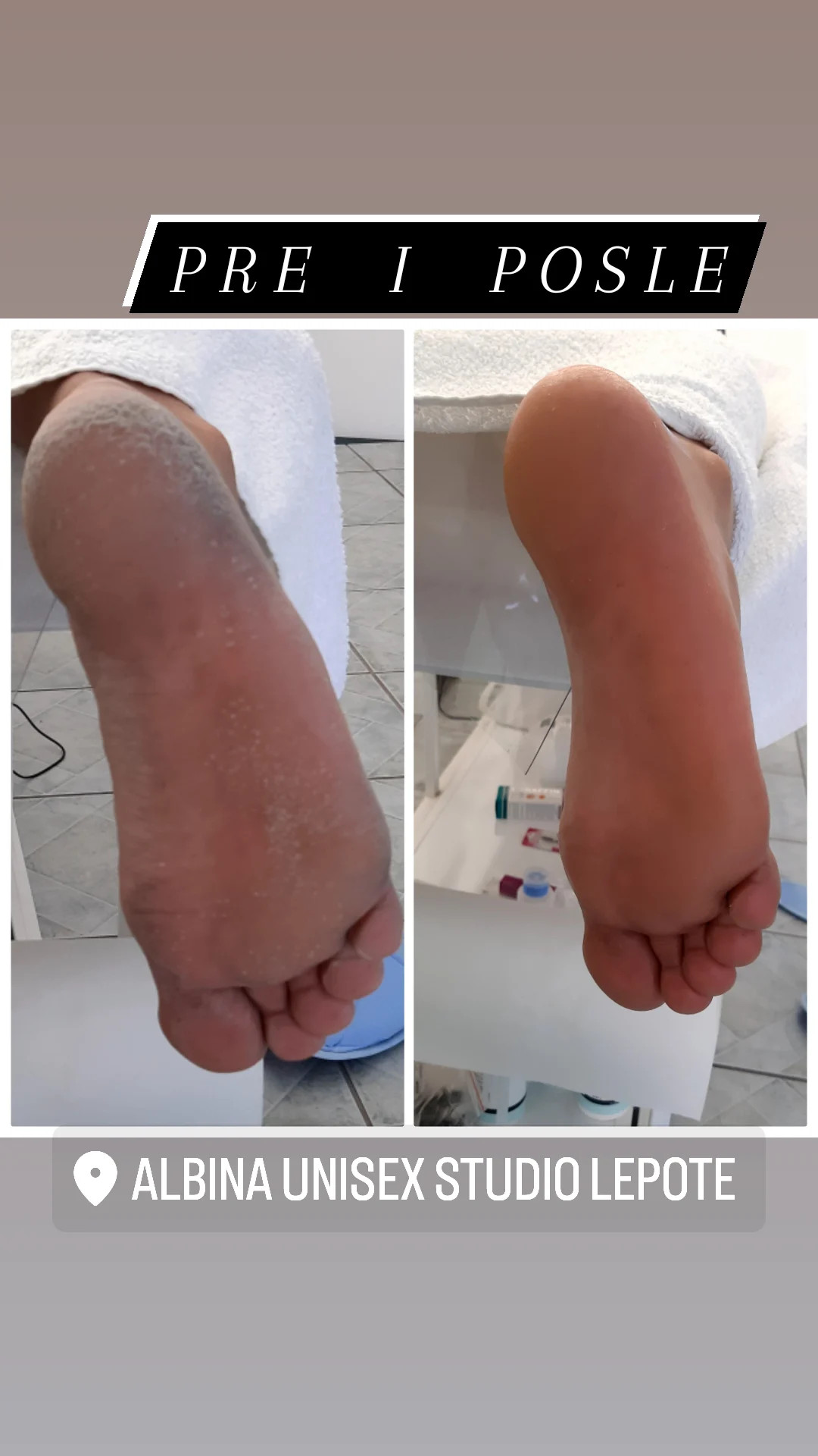 Estetski SPA pedikir za muškarce + masaža stopala GRATIS - Albina Unisex Studio Lepote, Temerin Estetski pedikir Nokti Estetski pedikir, Temerin, Centar