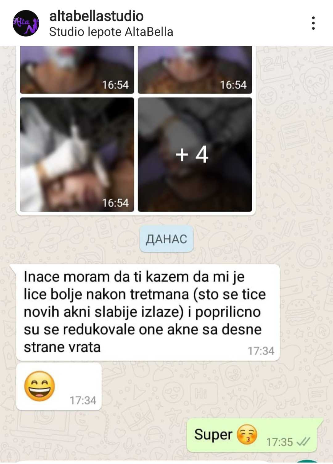 AltaBella Batajnica #beograd Laserski tretmani lica Lasersko uklanjanje akni i ožiljaka