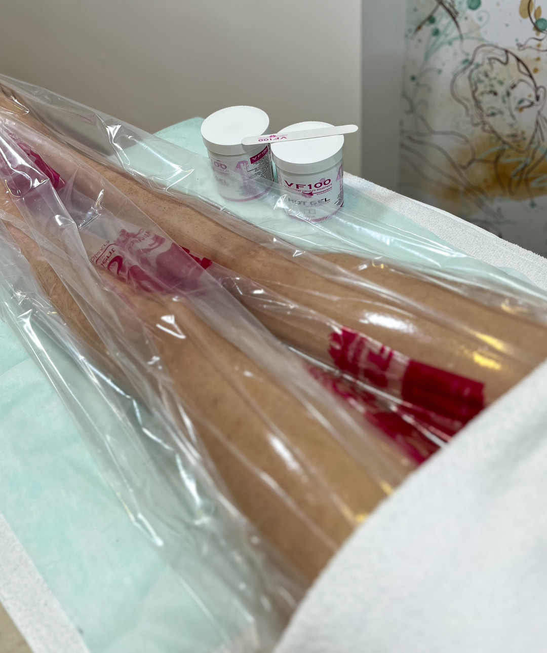 VIKTIA care atelier #beograd Masaža za mršavljenje Vakum fit - paket od 10 tretmana + 1 gratis