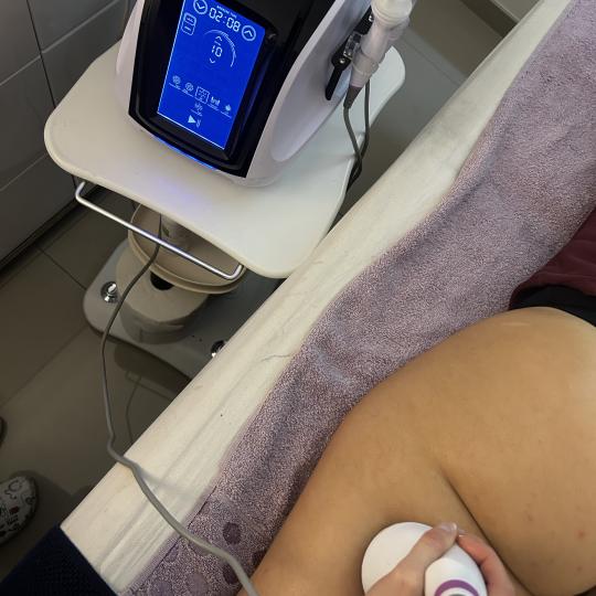 Mila Beauty Centar #beograd Tretmani tela Kavitacija - 1 regija