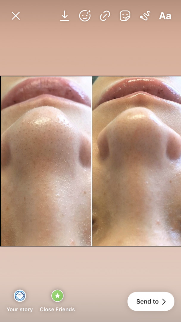SkinLab Beauty Centar #novisad Tretman lica Higijenski tretman lica