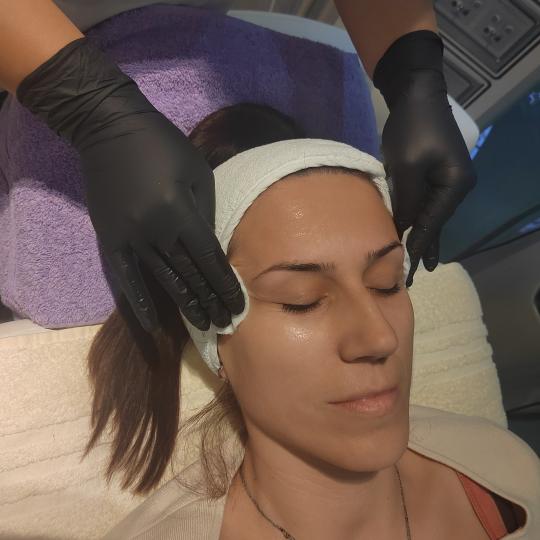 Belviso by Esposito #nis Tretman lica Mikrodermoabrazija lica