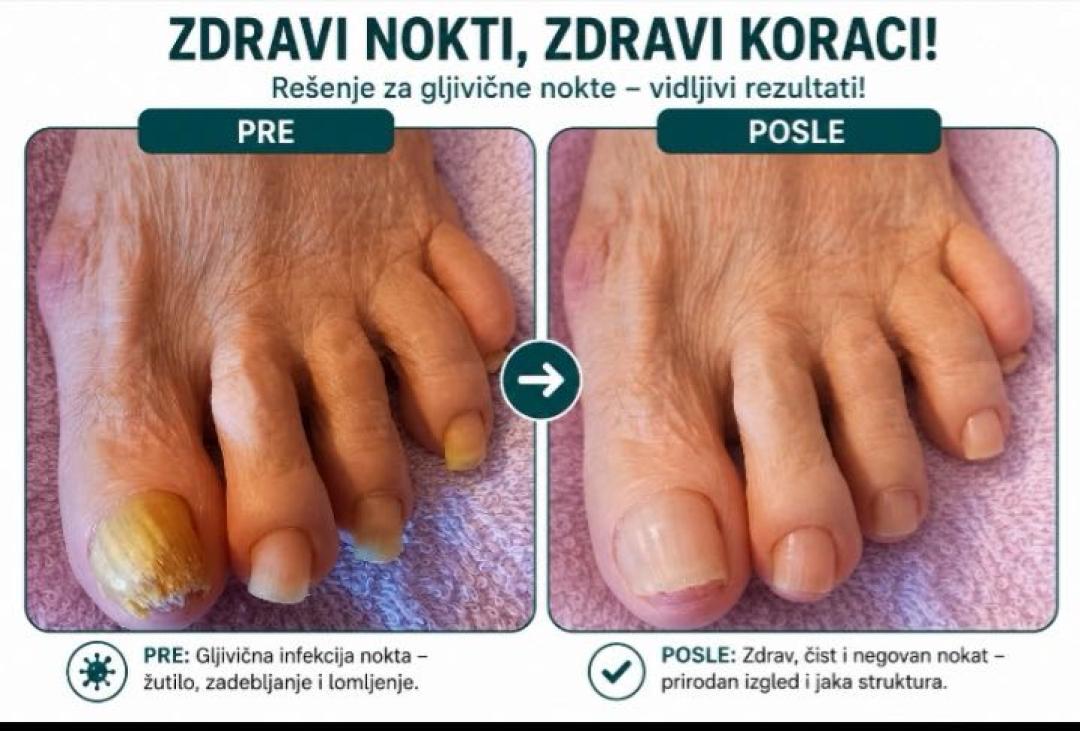 Medicinski pedikir - Fenix, Beograd Medicinski pedikir Nokti Medicinski pedikir, Beograd, Dušanovac, Šumice
