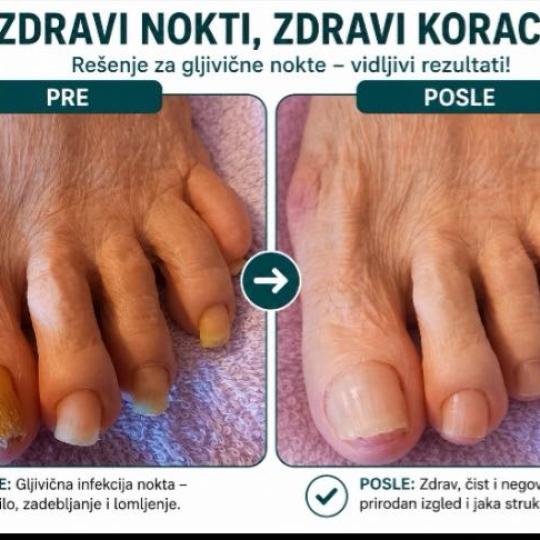 Fenix #beograd Medicinski pedikir Medicinski pedikir