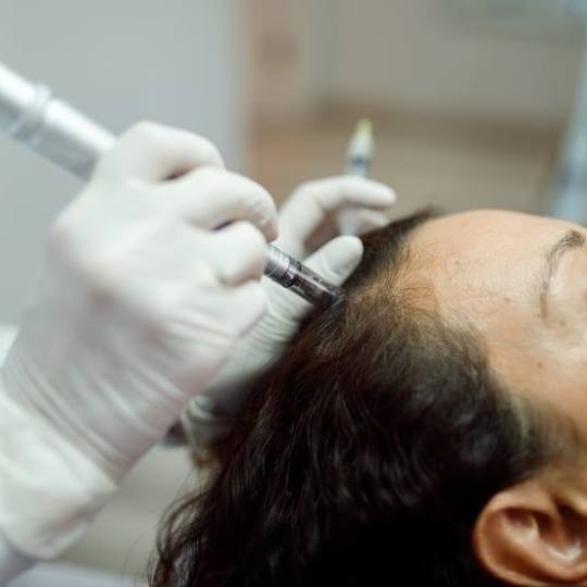 Knez #beograd Nega i ojačavanje kose Dermapen za rast kose - sve dužine kose Derma pen tretman za 