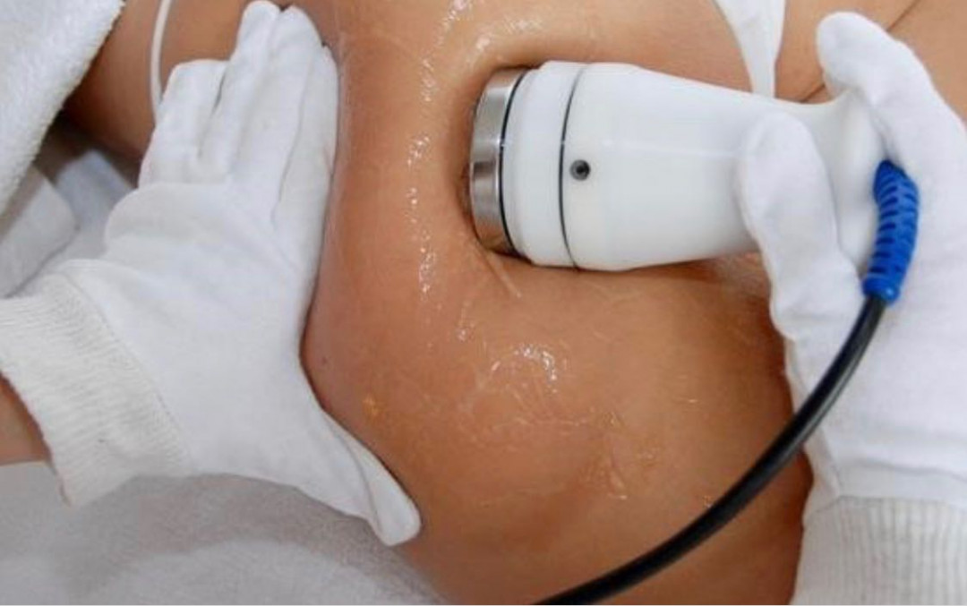 GM Beauty studio #beograd Kavitacija Kavitacija tela