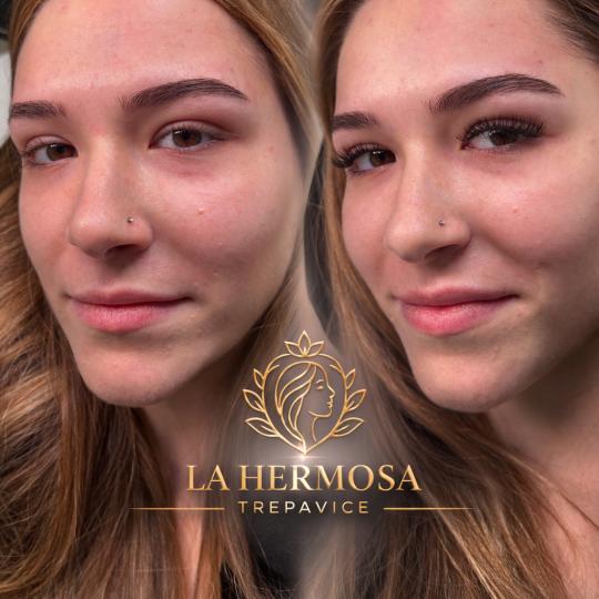 La Hermosa Beauty Studio #beograd Nadogradnja trepavica Nadogradnja svilenih trepavica - 1 na 1