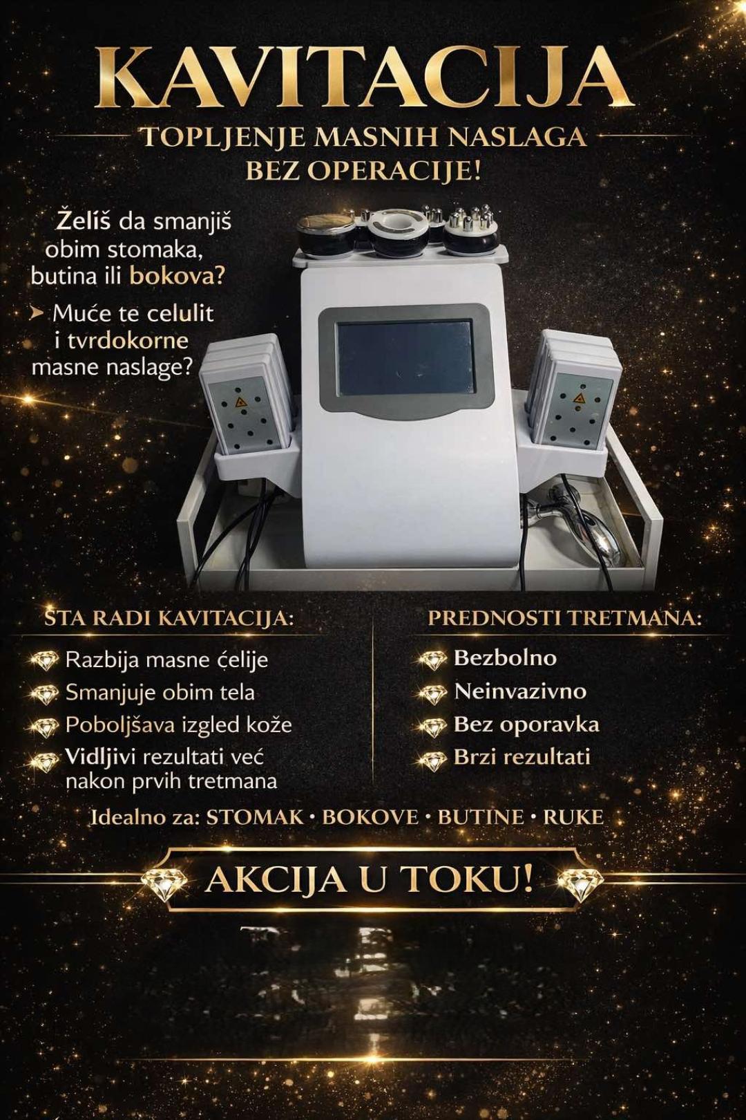 MS Beauty Centar #beograd Kavitacija Ultrazvučna kavitacija