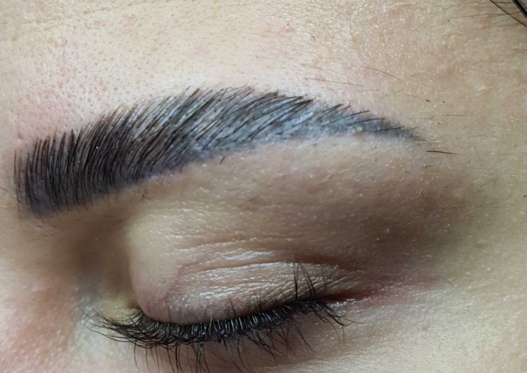 Brow lift - SunBox, Beograd Obrve Lice Obrve, Beograd, Vidikovac, Petlovo brdo, Labudovo brdo