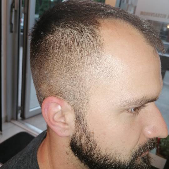 Salon Klinik #beograd Musko sisanje 500din