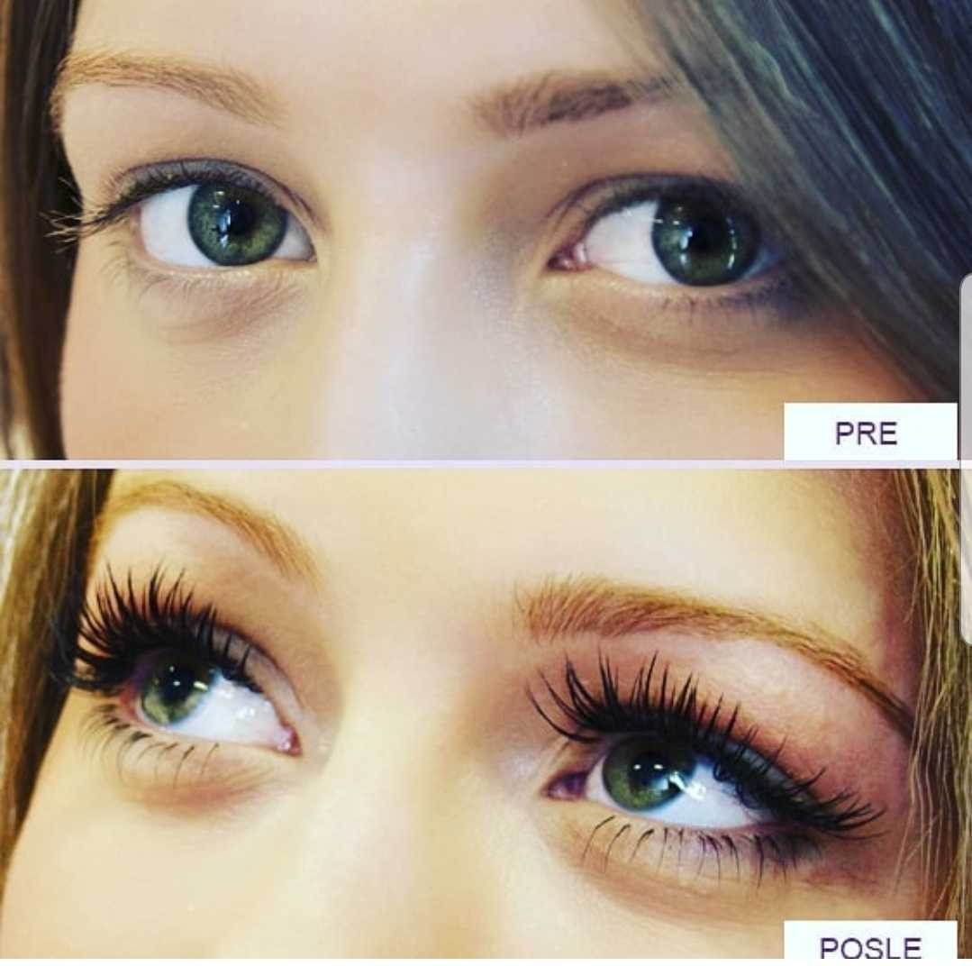 Grossi cosmetic #beograd Trepavice