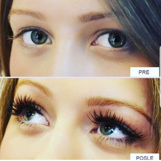 Grossi cosmetic #beograd Trepavice