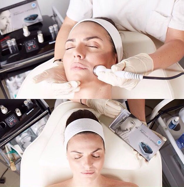 Beauty zone #beograd Tretman lica