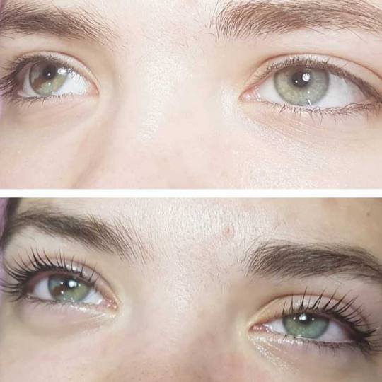 Beautyland #nis minival trepavica