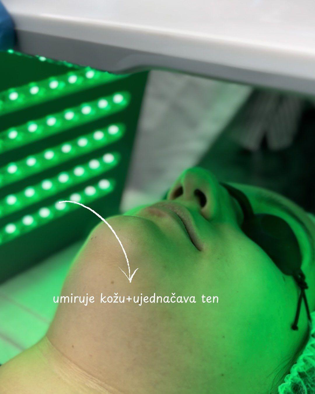 Led svetlosna terapija lica - AmiSo Beauty Studio, Novi Sad Tretman lica Lice Tretman lica, Novi Sad, Centar - Stari grad