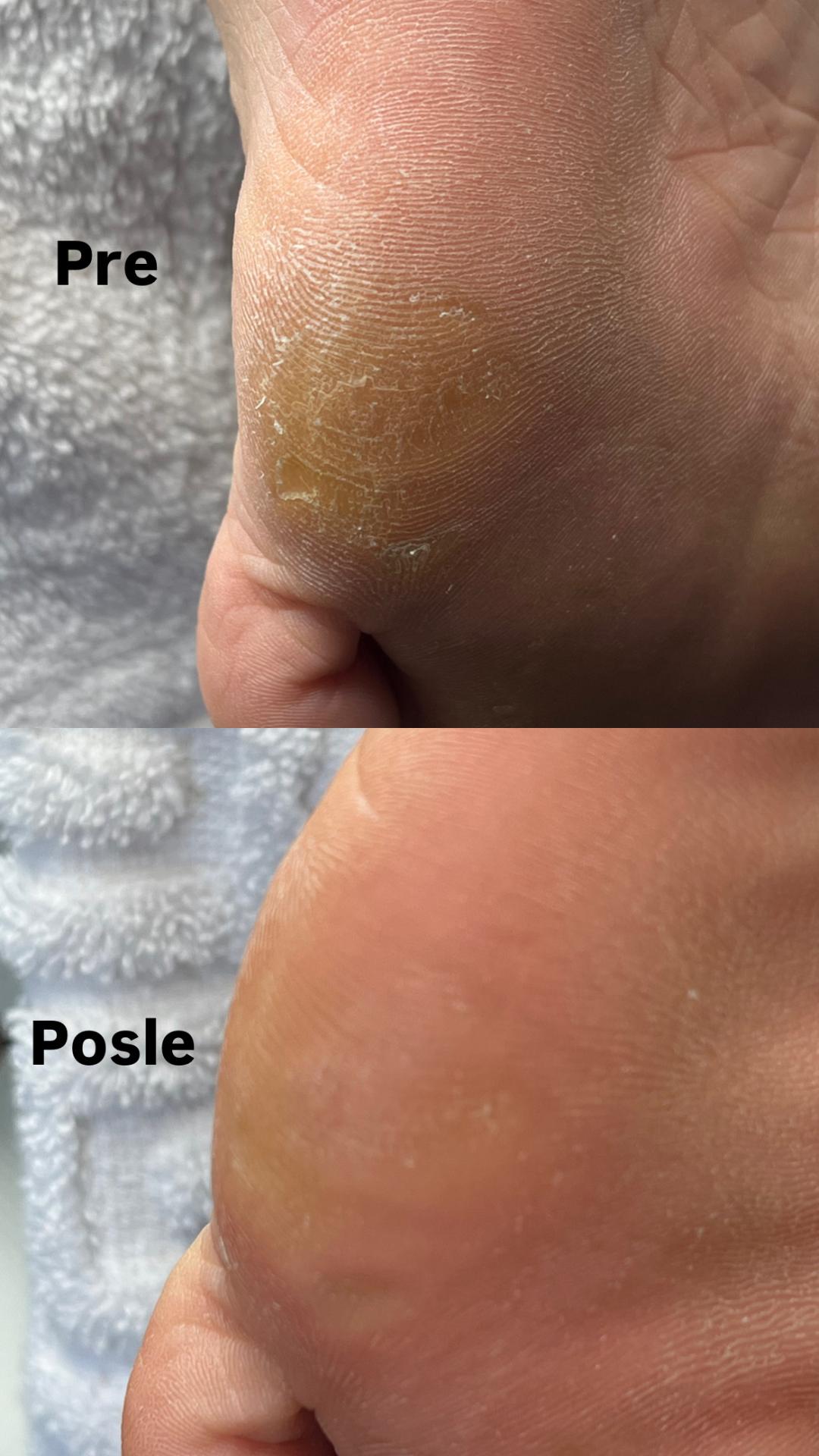 Belle Ana #beograd Estetski pedikir Ruski pedikir