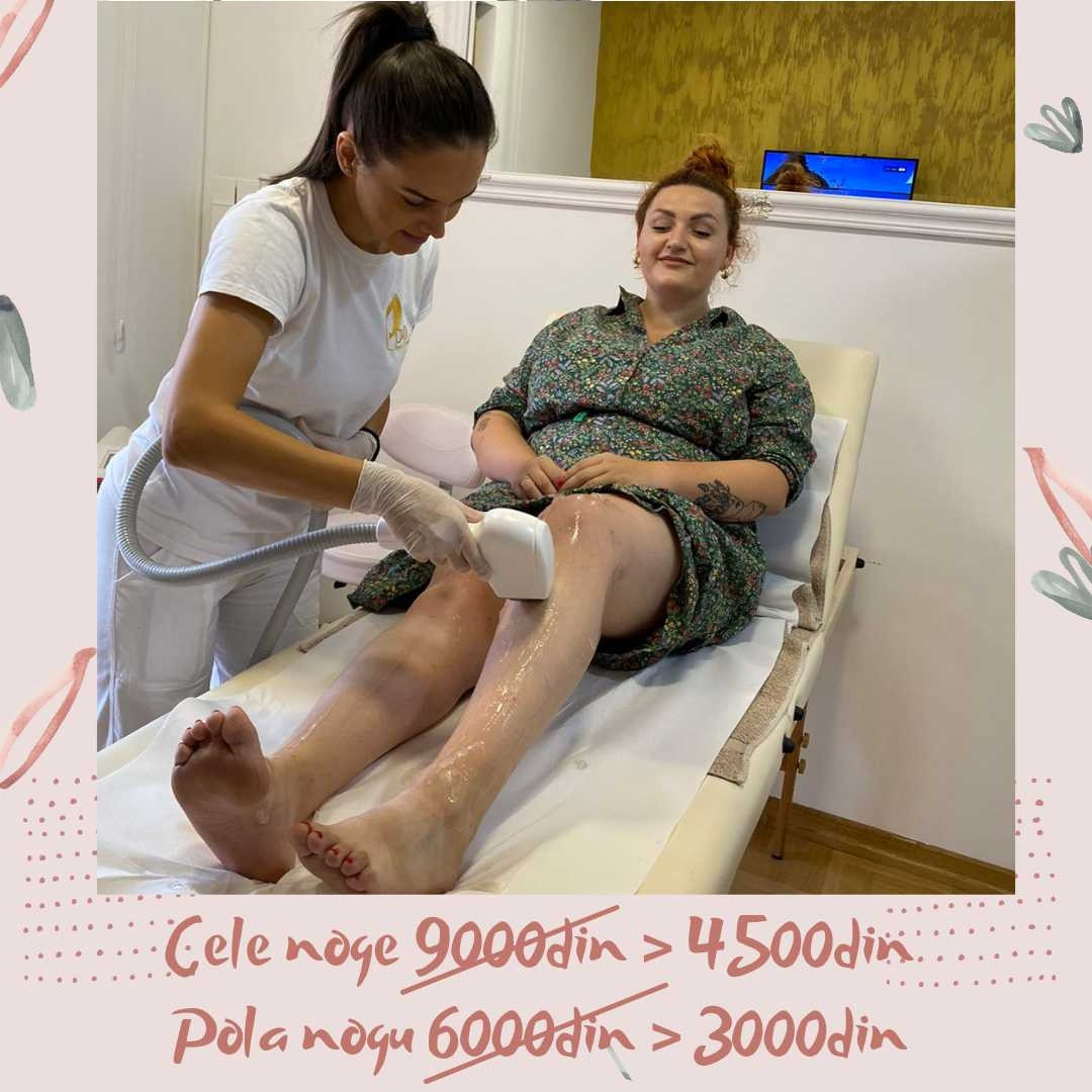 D&D Beauty Center #beograd Laserska epilacija Laserska epilacija celih nogu - za dame