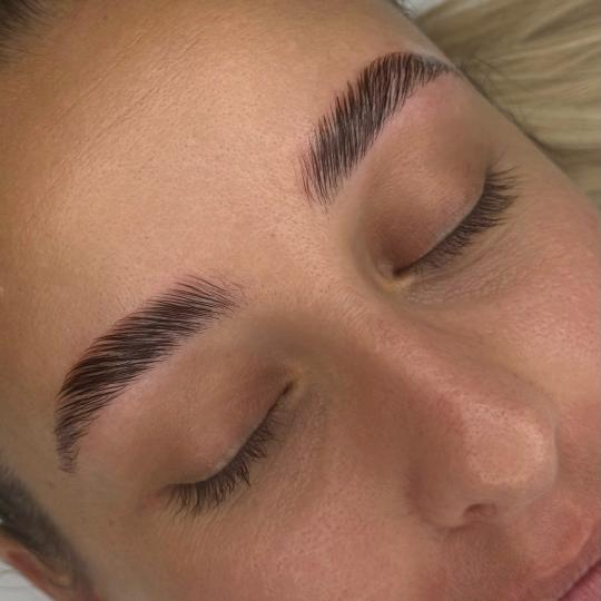 Esthetics Milica #mionica Obrve Brow lift