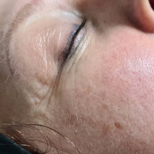 SunBox #beograd Masaža lica Face gym / Face fitness - anti age masaža lica