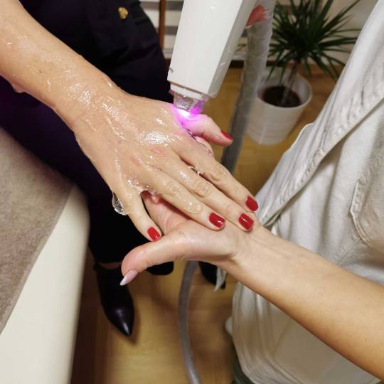 D&D Beauty Center #beograd Laserska epilacija Laserska epilacija celih ruku - za dame