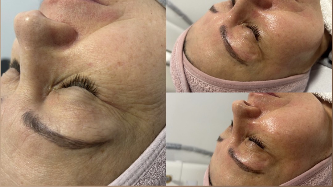 Ks Laser Beauty Centar #beograd