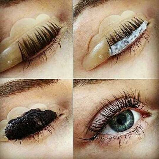 Be you 011 #beograd Botoks trepavica