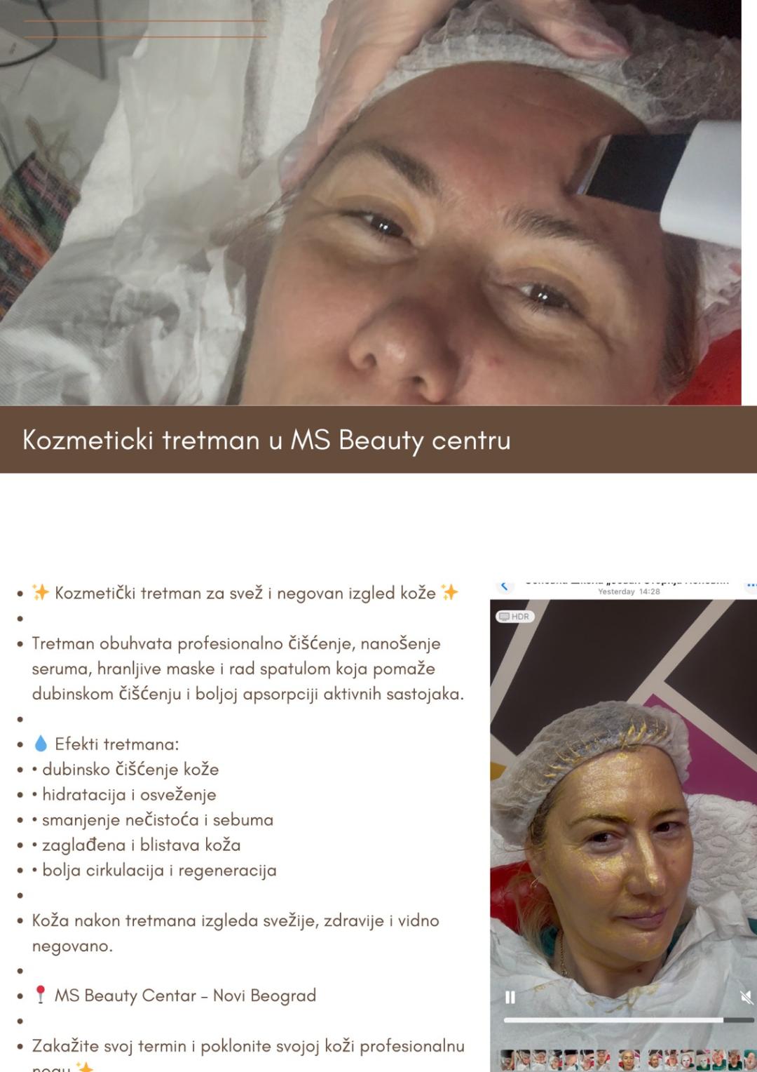 MS Beauty Centar #beograd