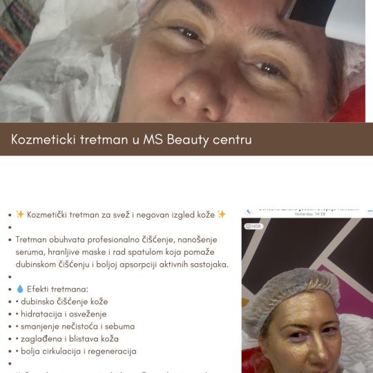 MS Beauty Centar #beograd
