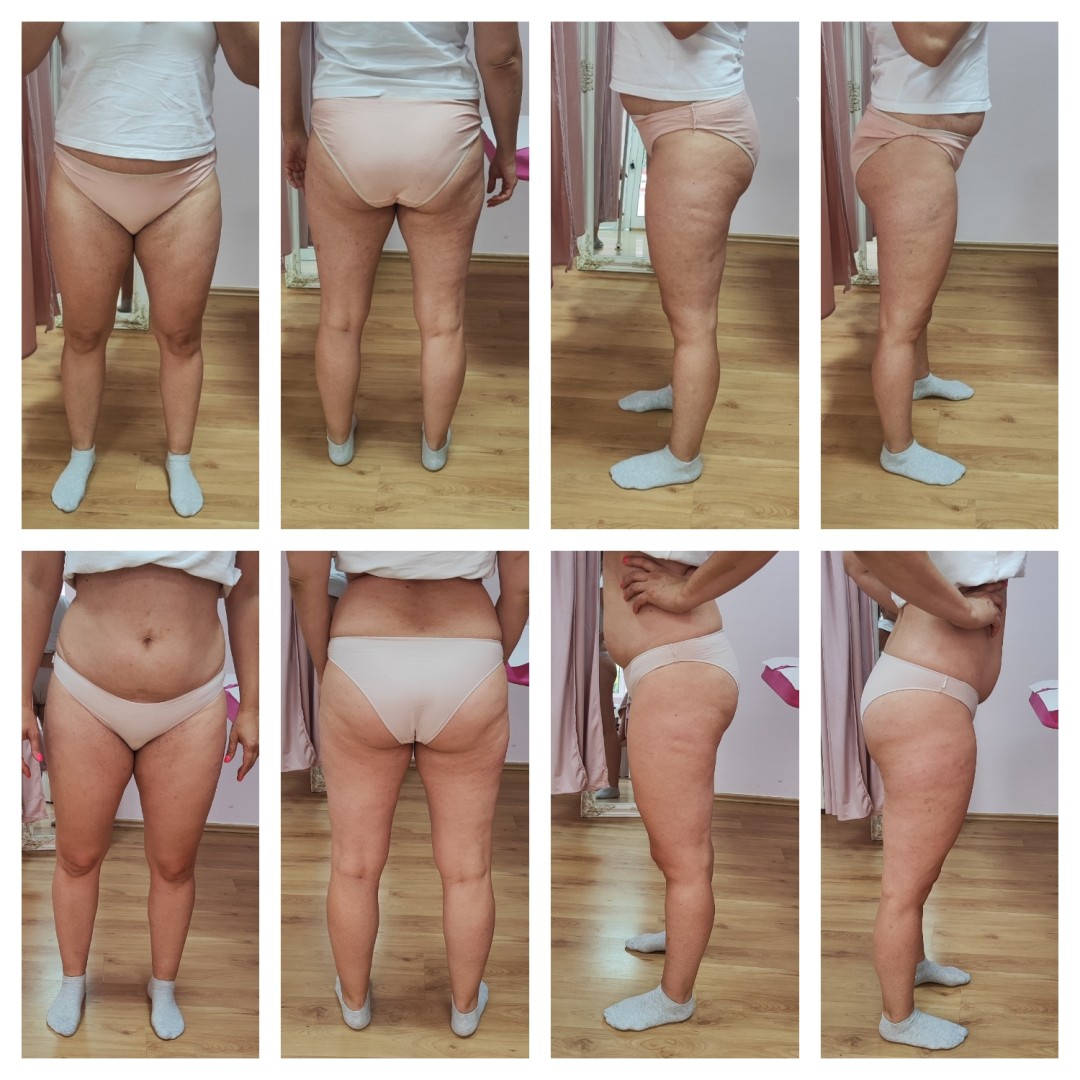 Mademoiselle Natalie studio #beograd Anticelulit LUX 10 maderoterapije+10 limfne drenaze+ brazilske madero+10 pakovanja