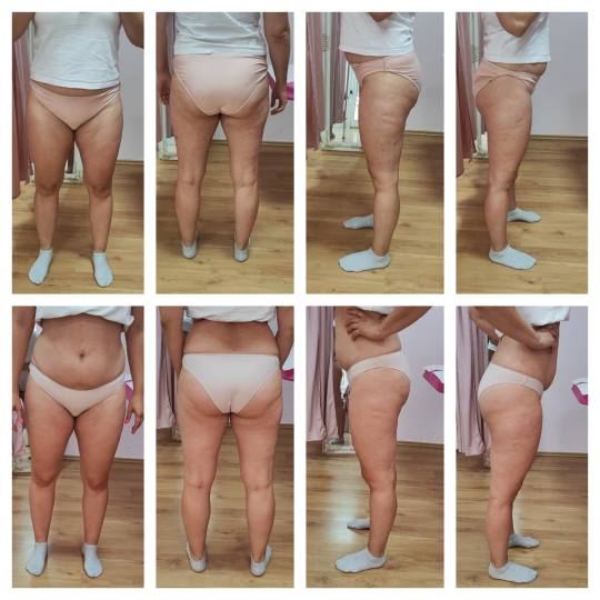 Mademoiselle Natalie studio #beograd Anticelulit LUX 10 maderoterapije+10 limfne drenaze+ brazilske 