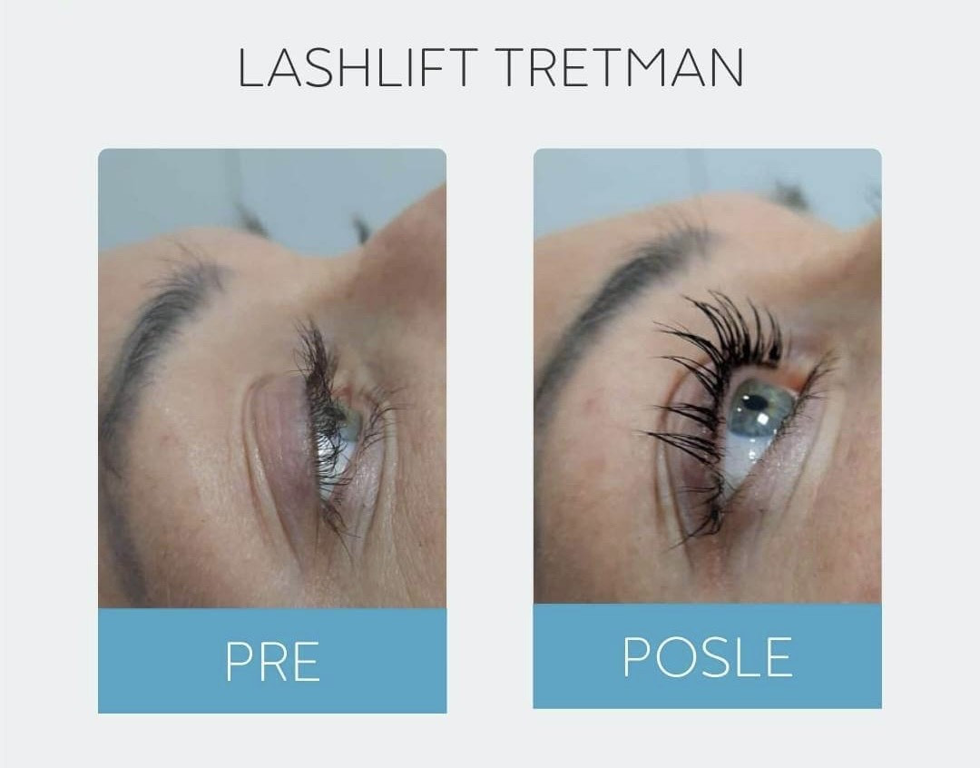 DepilConcept #beograd