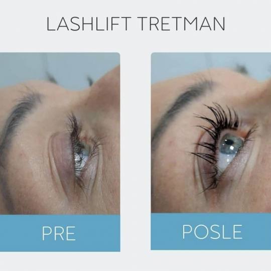 DepilConcept #beograd