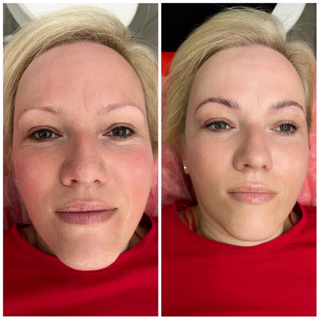 Brow lift - Beauty Studio Asja 2, Novi Sad Obrve Lice Obrve, Novi Sad, Rotkvarija, Podbara, Salajka