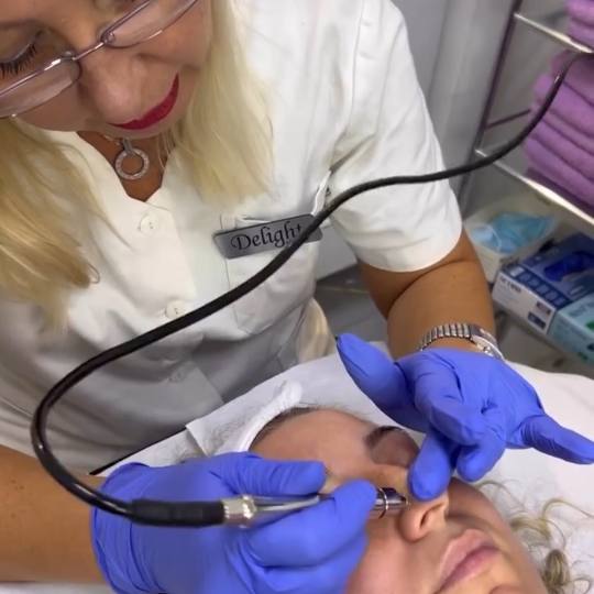 Laser centar Delight #beograd Piling lica Mikrodermoabrazija + kiseonik