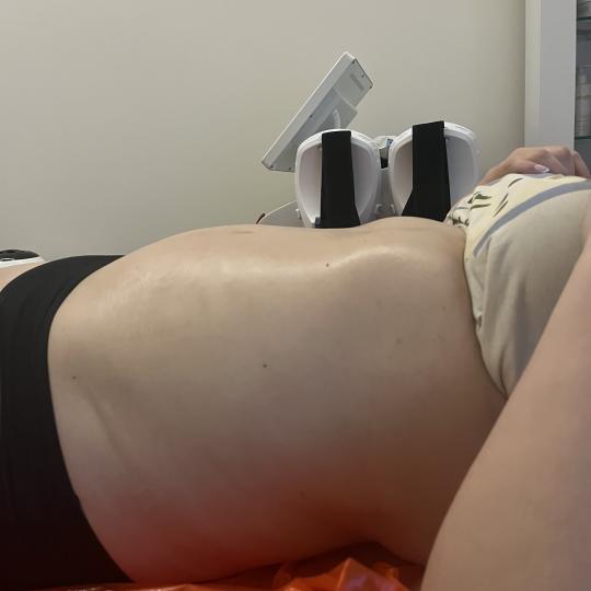 Diamond beauty #beograd Tretmani tela Kavitacija + EMS