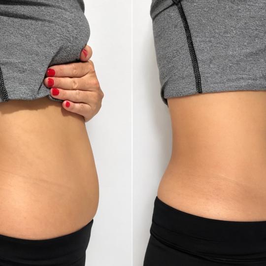 Amelini beauty concept usluga