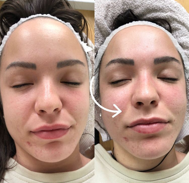 Makeup Olja Grbić #novisad Tretman lica Face gym masaža