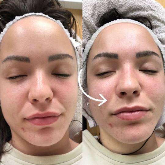 Makeup Olja Grbić #novisad Tretman lica Face gym masaža Trening mišića lica! Od samo jednog tret