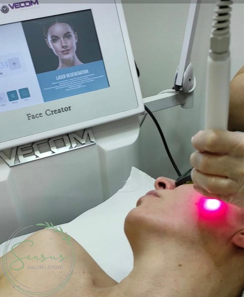 Bio stimulativni laser - protiv akni / ekcema + regeneracija tkiva - Sensus Zemun, Beograd Radiotalasni i ultrazvučni tretmani Telo Radiotalasni i ultrazvučni tretmani, Beograd, Zemun Centar