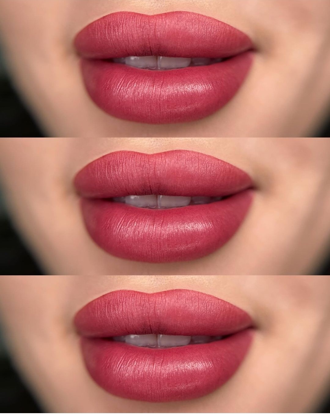 Esthetique Privé #beograd Trajna šminka Trajna šminka usana - PHILIPPS