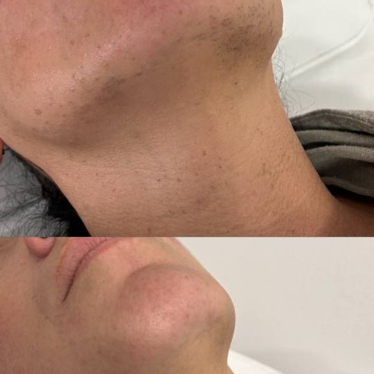 Lash & Light Studio usluga