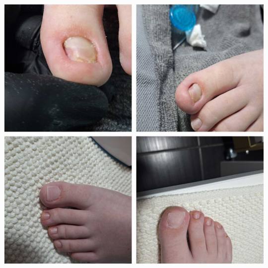 Bella4nails #beograd Estetski pedikir Estetski pedikir Nadogradnja nokta poli gelom.