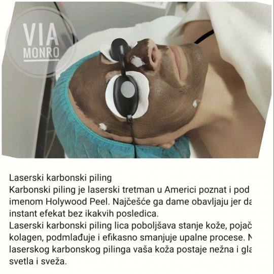 Andre Art #nis Tretman lica Laserski karbon piling lica