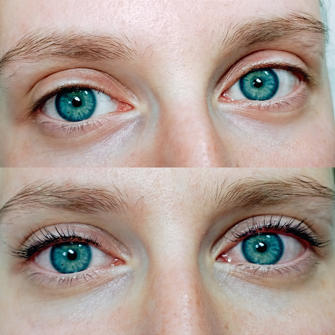 Factor Estetic #beograd Trepavice