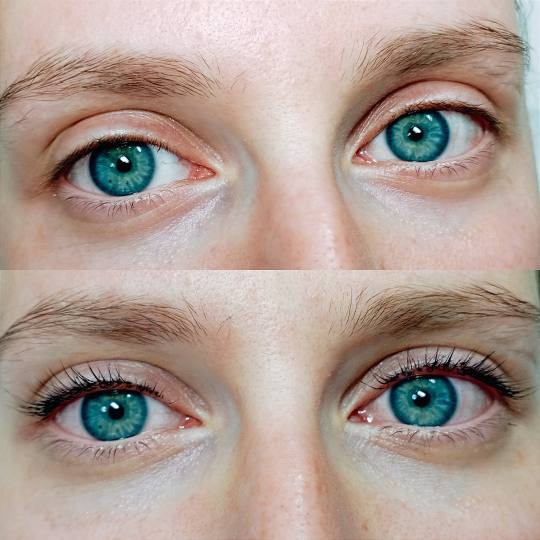 Factor Estetic #beograd Trepavice