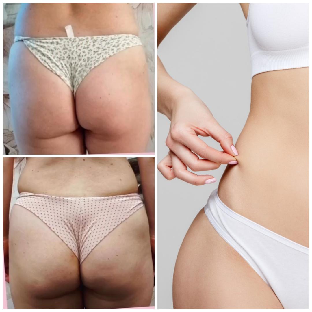 EMS tretman - 2 regije - Belle Ana, Beograd Tretmani tela Telo Tretmani tela, Beograd, Vračar, Čubura, Crveni krst