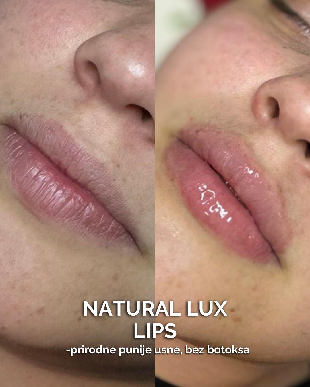 Natural lux lips - Natural Beauty Lux, Beograd Tretman lica Lice Tretman lica, Beograd, Bežanijska kosa, Bežanija, Ledine, Surčin