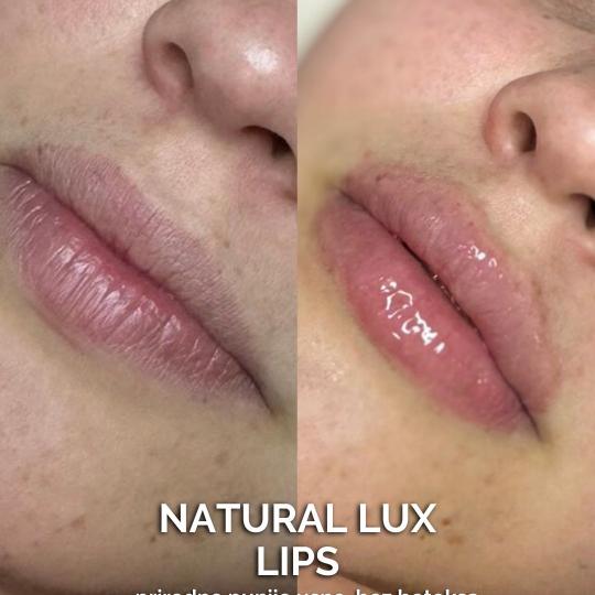 Natural Beauty Lux #beograd Tretman lica Natural lux lips ✨Natural Lux Lips 

Autorski tretman z